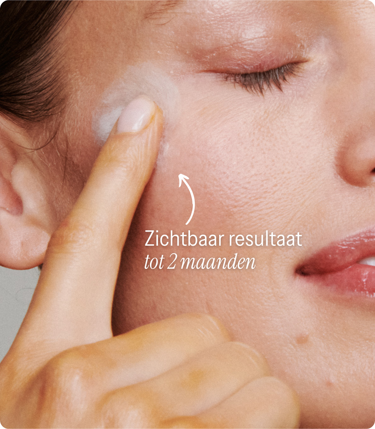 [lang:nl]