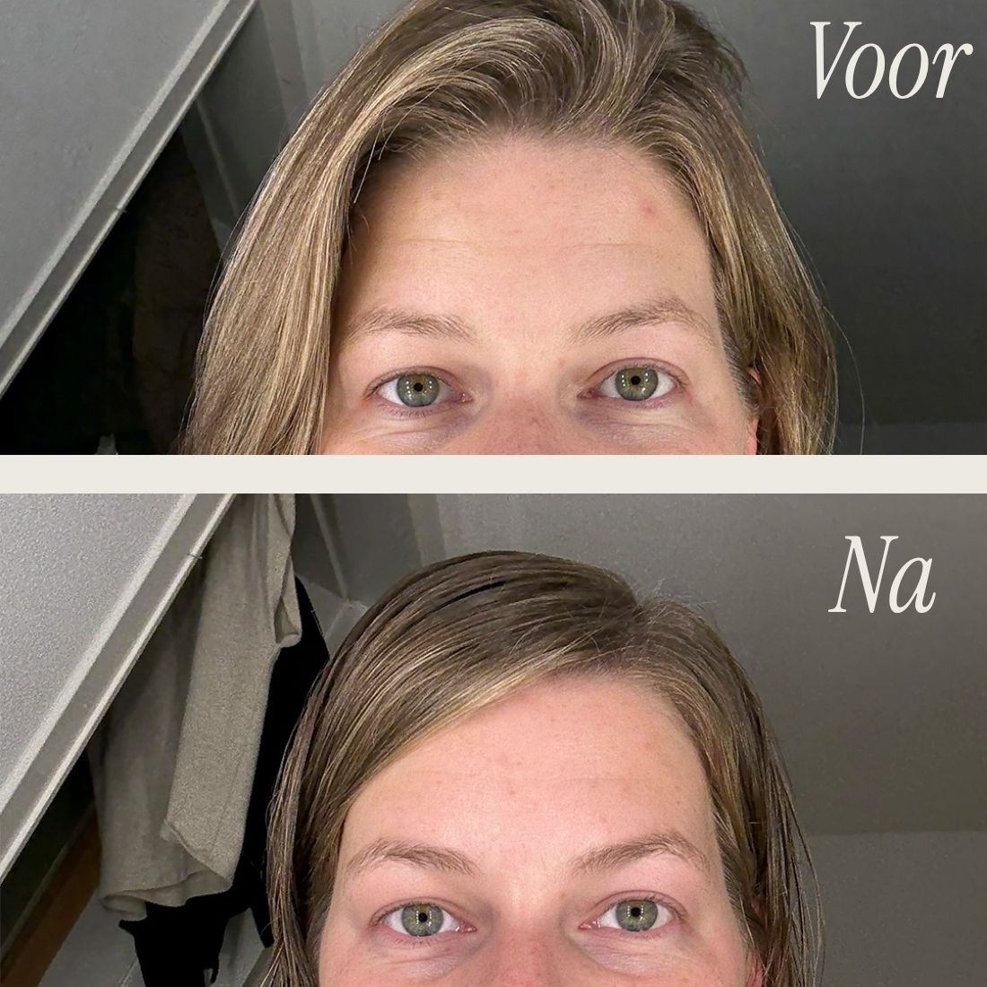 [lang:nl]